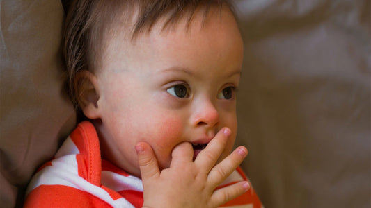 Red cheeks in infants what parents need to know