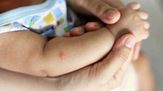 Understanding Bug Bites in Infants Prevention and Treatment Tips